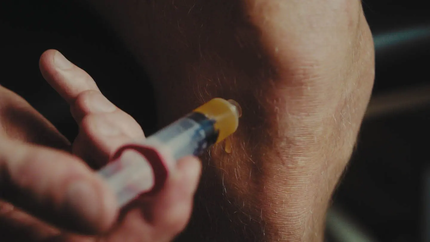 acp/prp injektioner